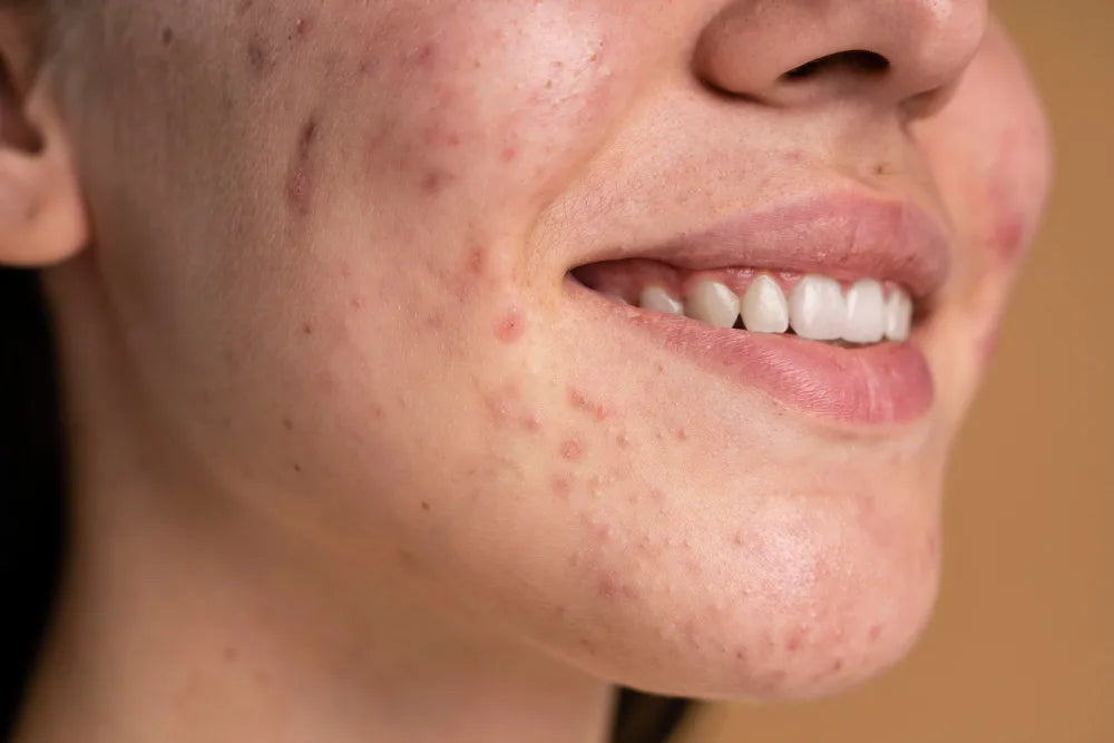 Sallow Skin Solutions