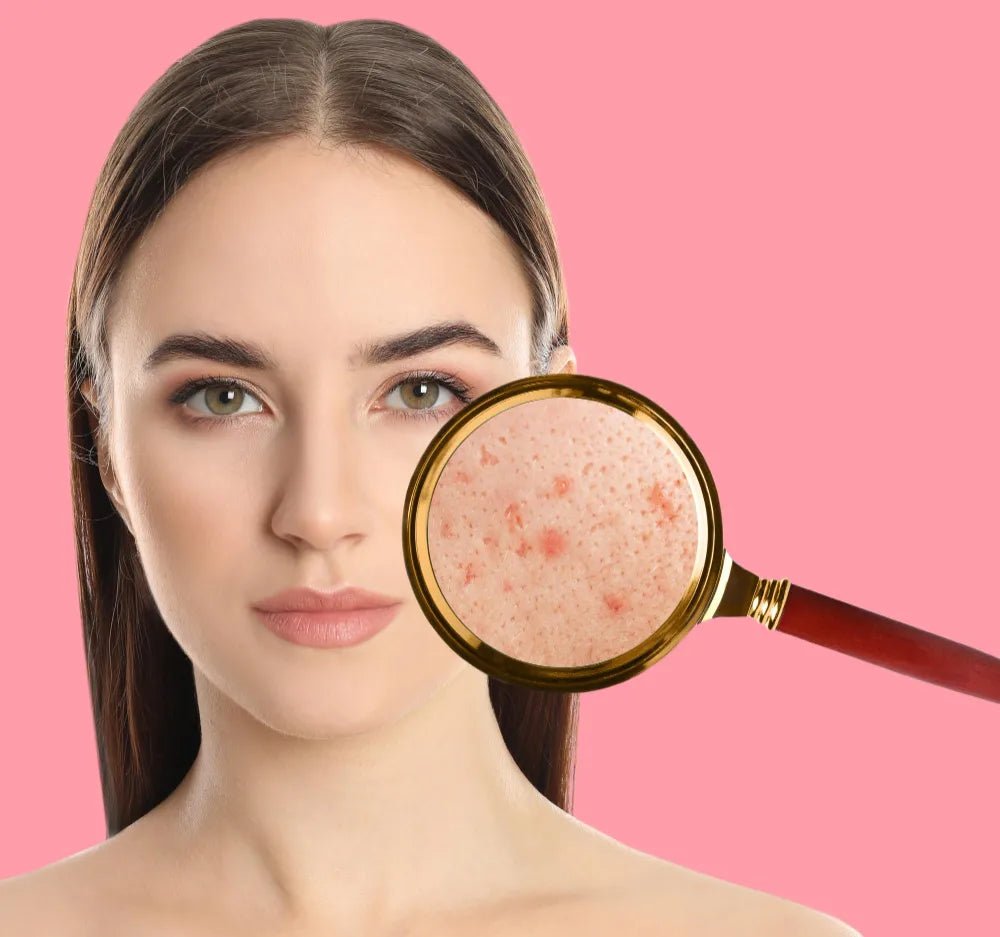 5 Ways to Unclog Pores and What to Avoid - Sweet Bee Naturals