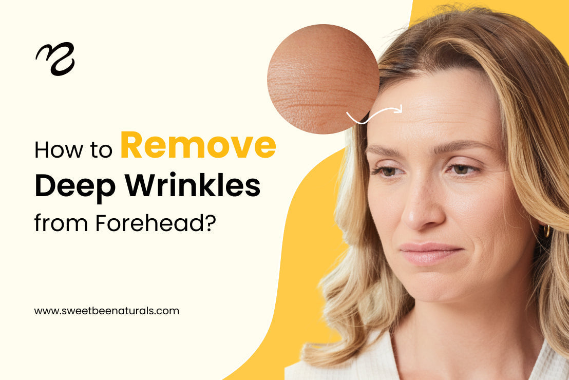 How to Remove Deep Wrinkles from Forehead?