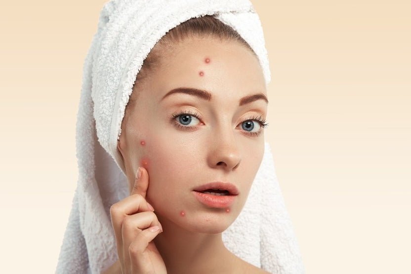 Brightening Sallow Skin with 10 Effective Lifestyle Changes