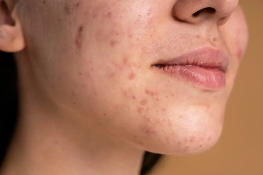 How to Get Smooth Skin: Easy Daily Tips - Sweet Bee Naturals