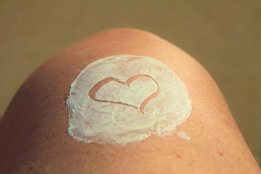 Soothe that Summer Sunburn! - Sweet Bee Naturals