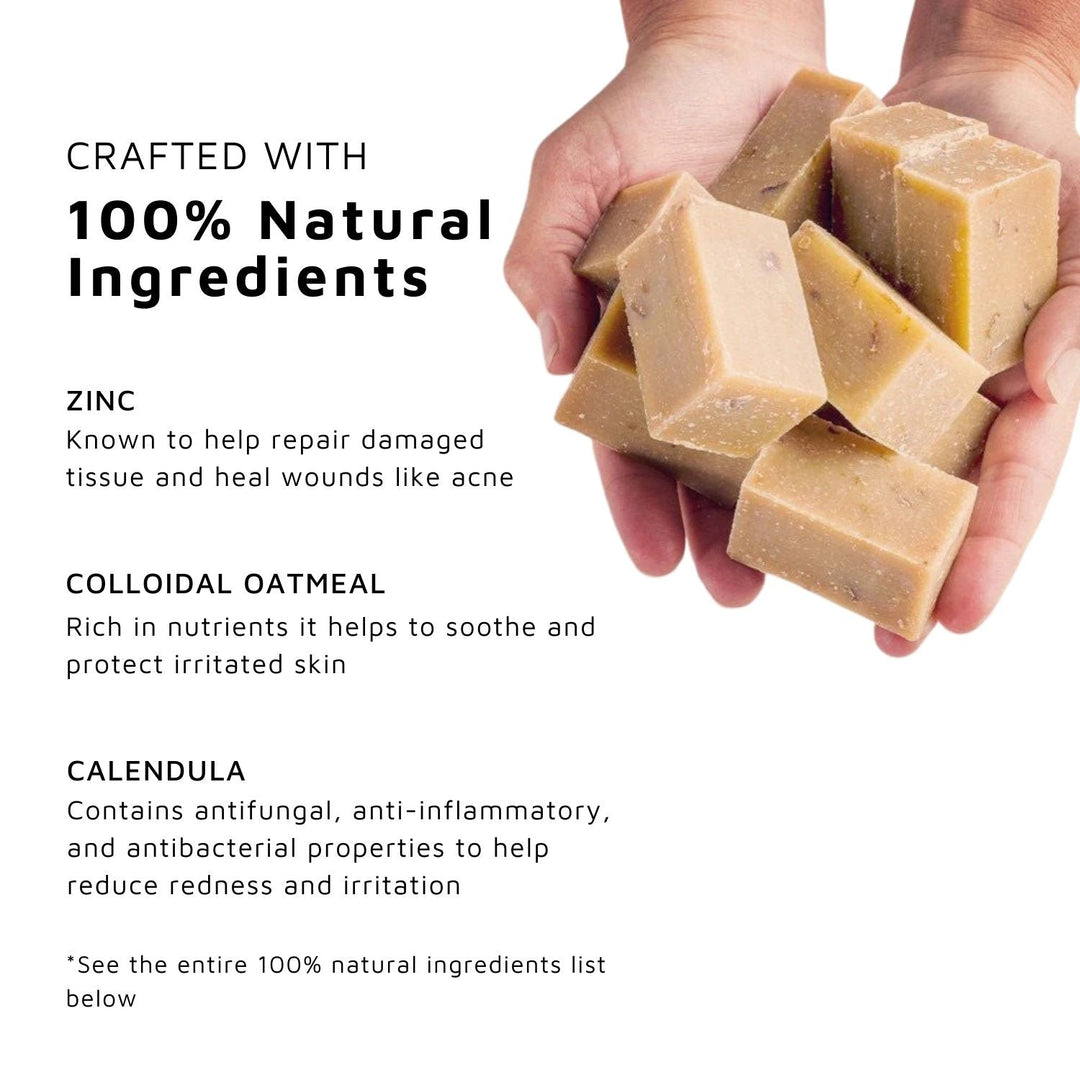 Zinc Facial Bar™ | Zinc Facial Soap - Sweet Bee Naturals